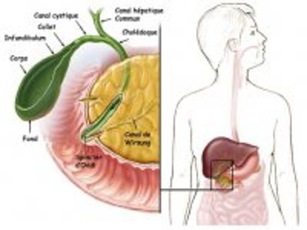 Ablation de la vésicule biliaire sous coelioscopie en ambulatoire